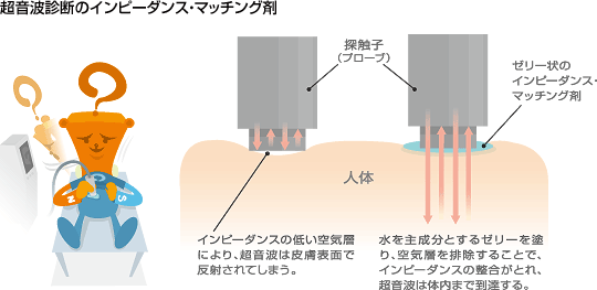 超音波診断のインピーダンスマッチング剤